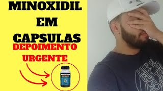 Minoxidil em cápsulas  Será que funciona Veja meu resultado de 8 meses