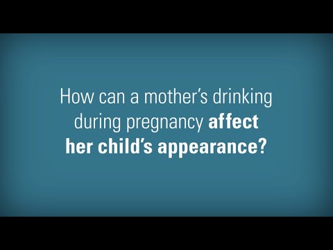 FAS FAQ: How Can a Mother's Drinking During Pregnancy Affect Her Child's Appearance?