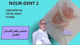 Grattage du total haut et bas تحضير طقم الأسنان الكامل @Nourdent
