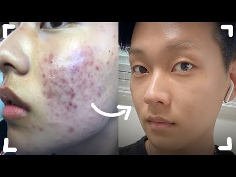 <strong>cc</strong>) 무조건 피부가좋아지는 스킨케어 루틴✨Skin <strong>care</strong> routine l 화니HWAN&amp;#39;E