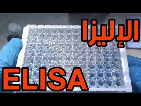 شرح نظري وعملي تقنية الإليزا ELISA Enzyme Linked Immunosorbent Assay