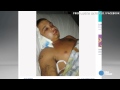 Funny: Cottonmouth Snake bites Teen's lip after being Caught