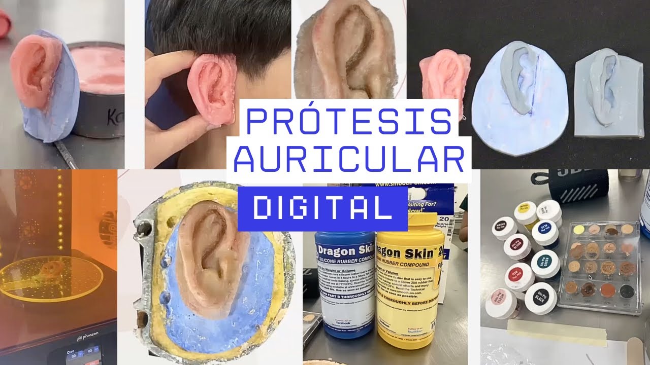 Prótesis auricular digital👂 💻