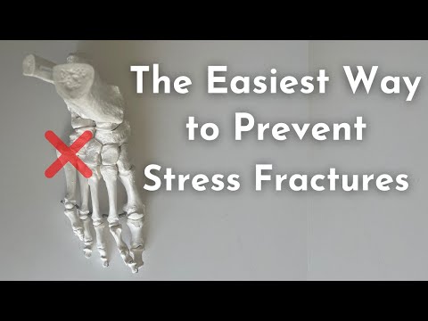 Video: Ar trebui să faci fracturi de stres cu gheață?