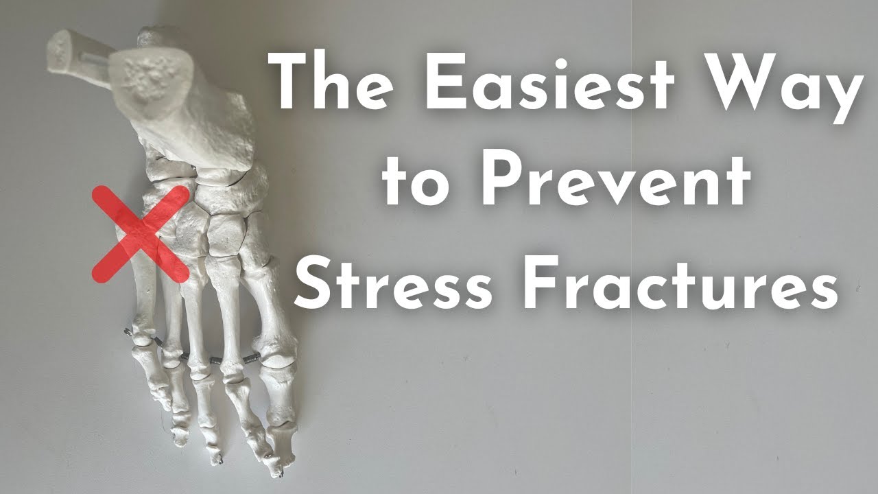Сделайте это, чтобы ОСТАНОВИТЬ стрессовые переломы 