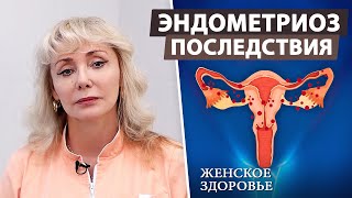 Эндометриоз: что это такое и как его лечить?