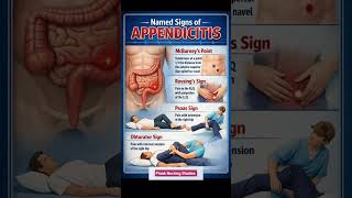 Signs of Appendicitis
