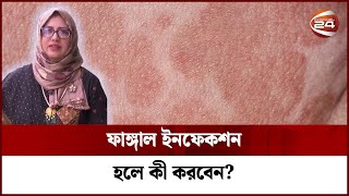 গরমে বেড়ে যায় ফাঙ্গাল ইনফেকশন, কী করা উচিৎ? | Fungal Infection | Dr Fahmida | Channel 24 screenshot 5