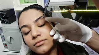 Eyebrow Piercing About  \