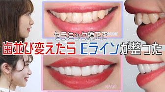 湘南美容クリニック 歯科 Youtube