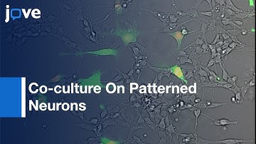 Co-culture Of Glioblastoma Cells: Migration Cellular Interactions Study | Protocol Preview