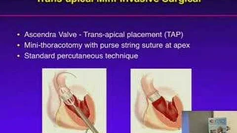Cardiovascular Innovations Reggie Low