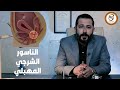 خاص للسيدات علشان يعرفوا ايه هو الناسور الشرجي المهبلي و اعراضه و طرق علاجة مع د رامي صلاح الدين