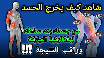 🤲"بصوت الشيخ علاء عقل: الرقية الشرعية لتحقيق الراحة والشفاء"aql