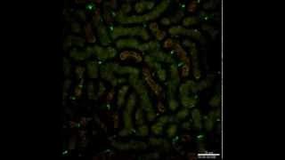 Ly6Chigh Monocytes Protect against Kidney Damage during Sepsis via a CX3CR1-Dependent Adhesion...