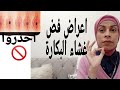 اعراض فض غشاءالبكارة للبنات اطمني أن غشاءك سليم