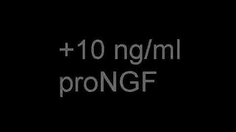 ProNGF leads to growth cone collapse (S1)