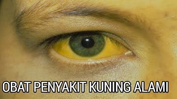 Cara menyembuhkan penyakit kuning dgn Produk K-link