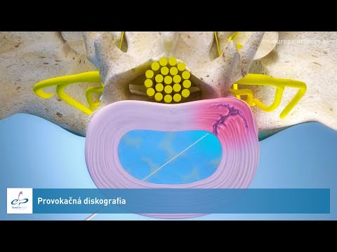 Video: Poškodená Senzácia: Príčiny, Diagnostika A Liečba