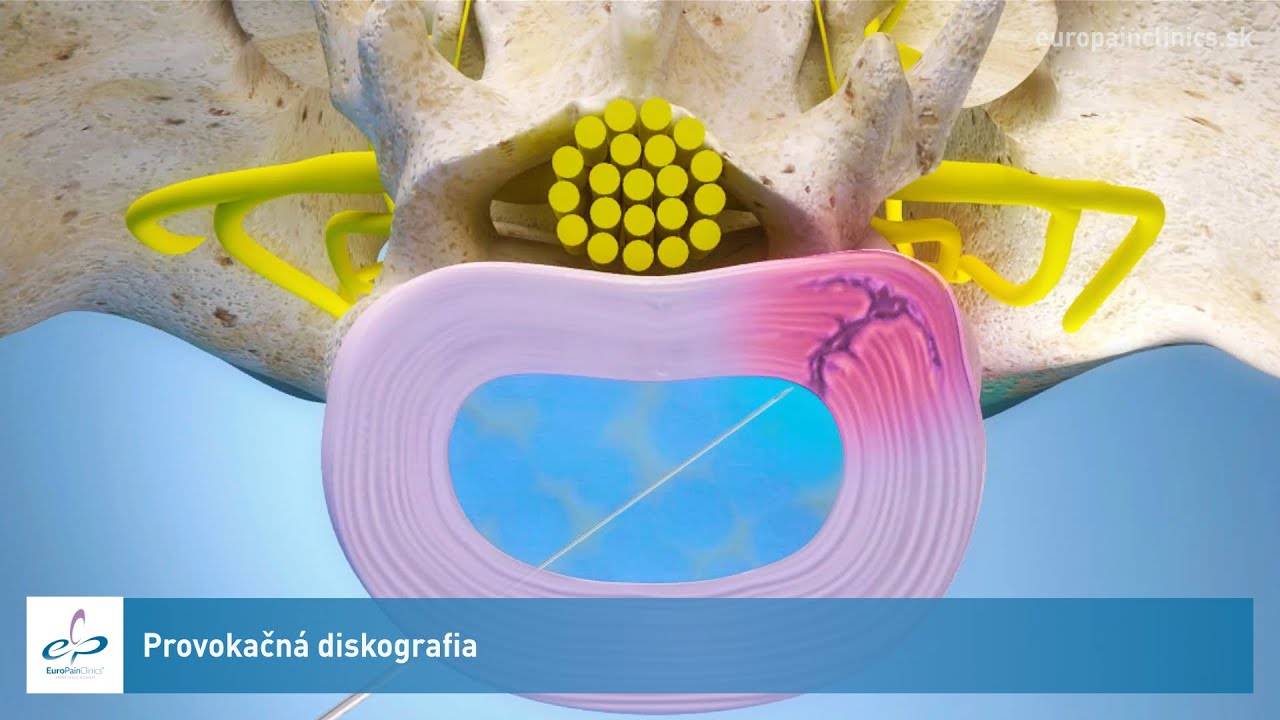 Provokačná diskografia
