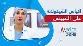 اكياس الشوكولاتة على المبيض وفرص الحمل | هل تؤثر على مخزون المبيض؟ د. ايمان الجندي | Medicazone