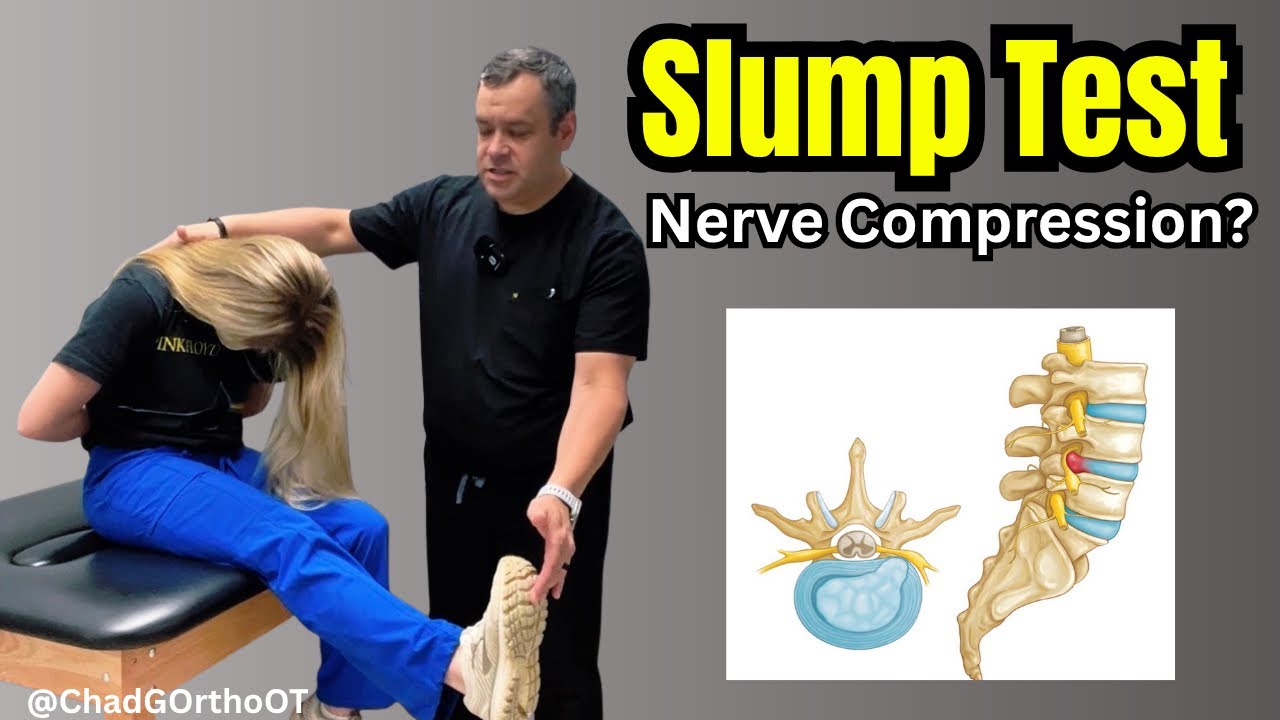 Slump Test Nerve