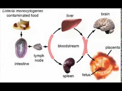 Listeria monocytogenes, gram-positive rod, one cause of ...