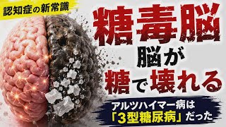 【恐怖】認知症の原因、”糖毒脳”とはどんな病気か？　アルツハイマーを起こす原因は〇〇だった…