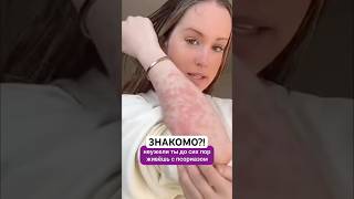 Заказать Псорифенак можно на Wildberries. Артикул - 430728516