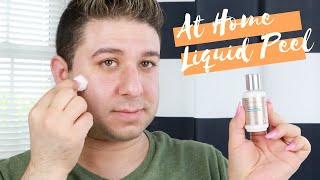 DR DENNIS GROSS CLINICAL GRADE RESURFCING PEEL REVIEW AND DEMO Brett Guy Glam