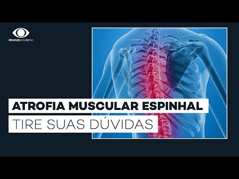 Vídeo: Como diagnosticar a atrofia muscular espinhal