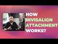 How Invisalign attachments work? | Cosmetic Dentist Preston