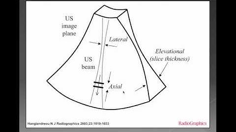 Ultrasound Physics 4 - Beam Geometry