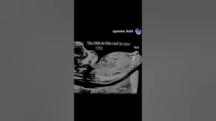 Gender reveal with NubX!