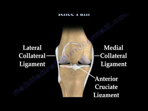 Video: Cum este diagnosticată tulburarea internă a genunchiului?