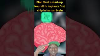Elon Musk's start-up Neuralink implants first chip in human brain #stayinformed #missionfieldtv