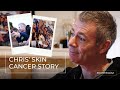 Chris’ Skin Cancer Story | #DontMissOut