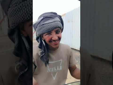 قرصه النحل مسكين شوف الوجه كيف صار