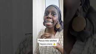 PEAU SÈCHE, PEAU TRES SÈCHE, PEAU ATOPIQUE : ESSAYEZ DERMINA screenshot 5