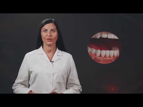 Video: Senovinio žmogaus Dantyse Rastas Mirtinas Virusas - Alternatyvus Vaizdas