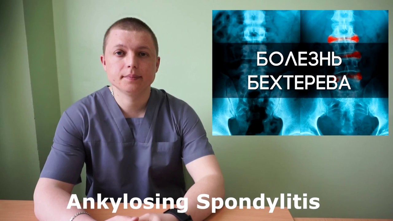 Болезнь Бехтерева | Bekhterev's disease | Остеохондроз | Ревматоидный Артрит