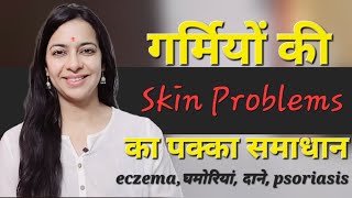गर्मियों की Skin problems दूर करें | Eczema, घमोरियां, दाने, Allergy, Psorisis का natural समाधान