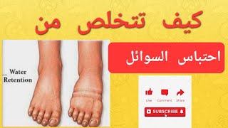 كيف تتخلص من احتباس السوائل بالجسم ⁉️⁉️⁉️