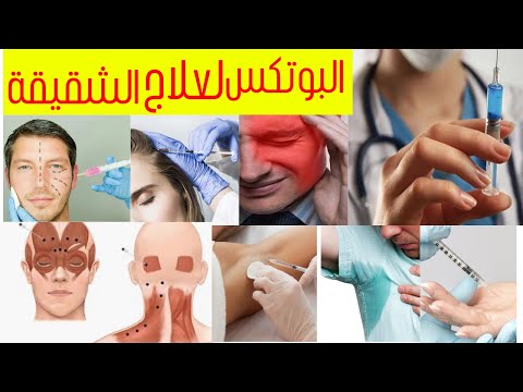 علاج الشقيقة وحب الشباب فرط التعرق الإبتسامة اللثوية في حقن إبرة البوتكس شرح دكتورة الجلدية