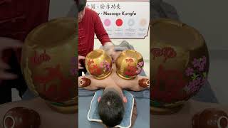 Download Lagu Happy Lunar New Year #cuppingtherapy #2025 MP3 Download Lagu Happy Lunar New Year #cuppingtherapy #2025 MP3