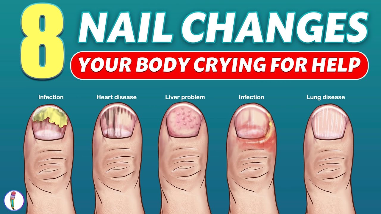 Fingernails can provide clues to your overall health