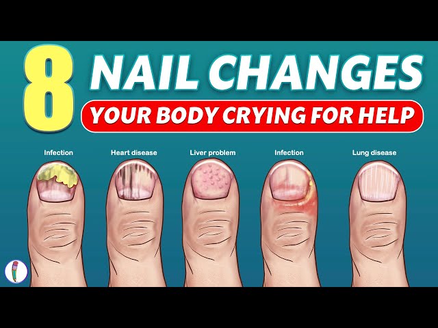 Nail disorders in children - Know the types and causes