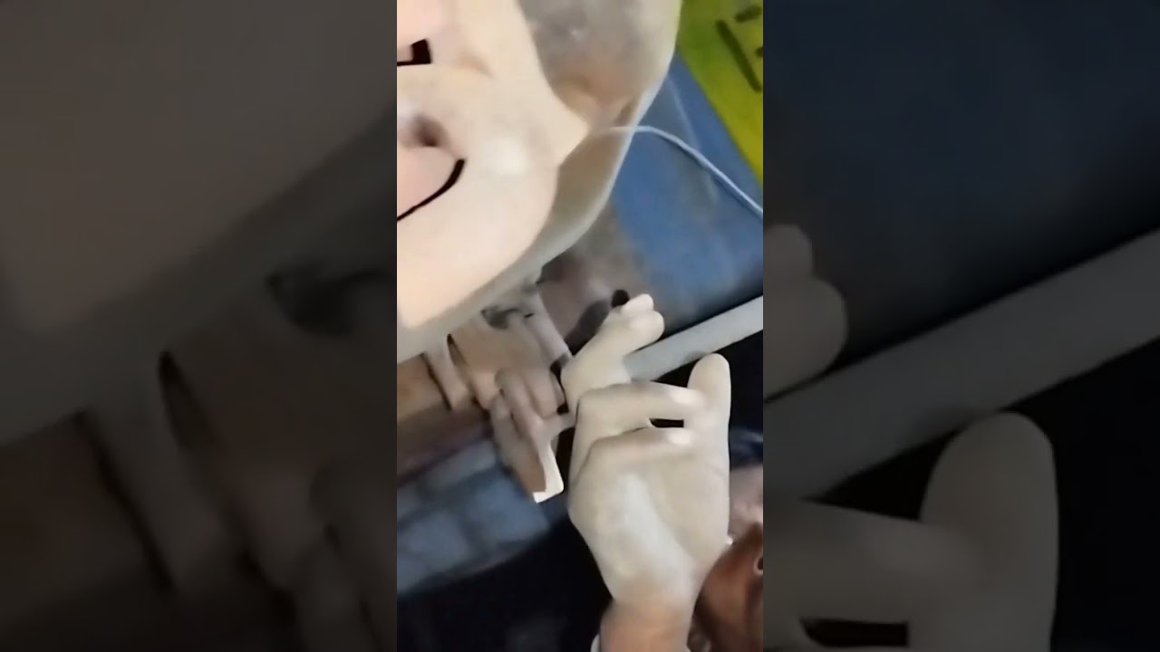 Centre Buffer Coupler pin Missing 