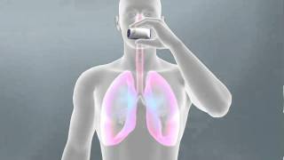 Respiratory Drug Delivery - Medical Animation by Watermark