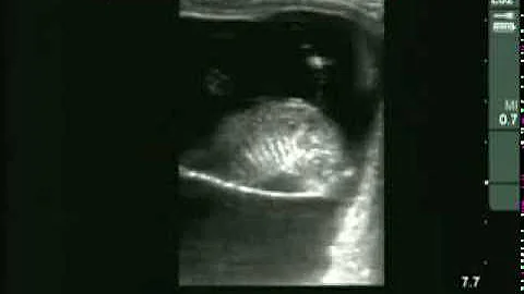 Cow #4539 Day 66 of Gestation